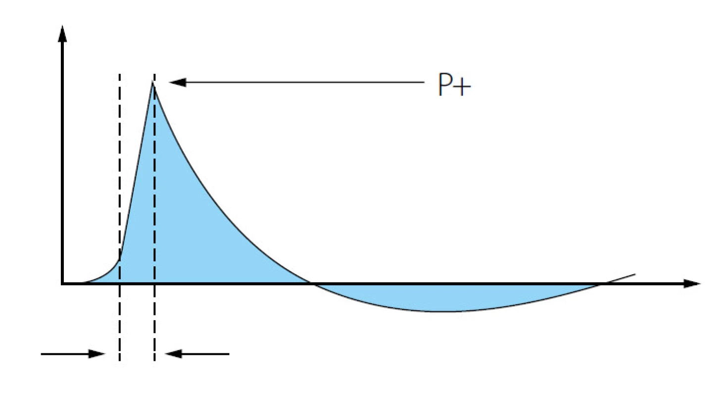 Charakteristika rázové vlny (24)
Fig. 1. General profile of shockwave (24)