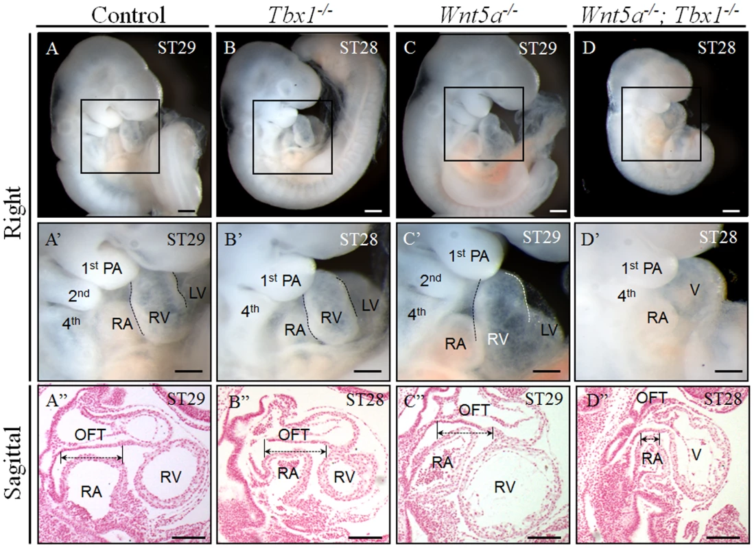 <i>Tbx1<sup>−/−</sup>;Wnt5a<sup>−/−</sup></i> embryos have severe cardiac abnormalities.