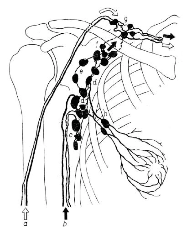 Lymfatické cévy ústící do lymfatických uzlin axily: a - lymfatické cévy podél vena cephalica (Mascagniho svazek) ústící do supraklavikulárních uzlin (g) , b - hlavní lymfatické cévy, přivádějící lymfu z horní končetiny do uzlin axily, c - uzliny subskapulární, d - uzliny axilární centrální, e - uzliny axilární laterální (brachiální nebo uzliny podél vena axillaris), f - uzliny axilární apikální (infraklavikulárni nebo subklavikulární), g - uzliny supraklavikulární odvádějící lymfu do hlubokých krčních uzlin, h - uzliny pektorální, odvádějící lymfu z prsu. Převzato se svolením autora [7].
