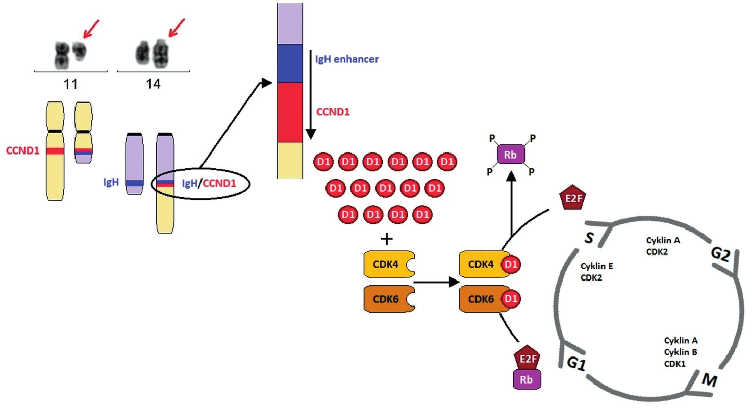 Schéma t(11;14)(q13;q32) a její vliv na patogenezi MCL
Translokace t(11;14)(q13;q32) vede k tvorbě derivovaného chromozomu 11, který je výrazně kratší než normální chromozom 11, a derivovaného chromozomu 14, který je naopak výrazně delší. 
V důsledku translokace dochází k přemístění genu CCND1 na chromozomu 11 v pruhu q13 pod zesilovač transkripce těžkých řetězců imunoglobulinových genů (IgH) na chromozom 14 v pruhu q32. Na derivovaném chromozomu 14 vzniká fuzní gen IgH/CCND1. V normálních lymfocytech expresi cyklinu D1 detekovat nelze, ovšem následkem t(11;14), respektive t(2;11)/t(11;22) je gen CCND1 konstitutivně přepisován a jeho hladina zůstává v buňkách MCL vysoká. Cyklin D1 funguje jako spouštěč buněčného cyklu, vazbou s cyklin-   ependentní kinázou 4 a 6 (CDK4, CDK6) vytváří komplex, který fosforyluje Rb1 protein a dochází k aktivaci řady transkripčních faktorů, které umožní vstup do další fáze buněčného cyklu.