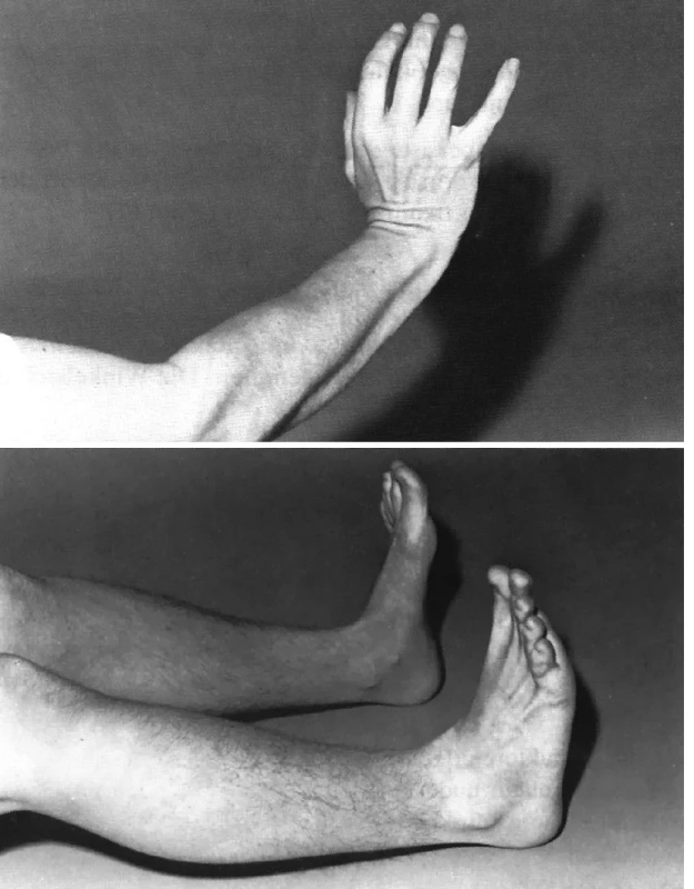 Výchozí postavení a) rukou, b) nohou při vzpěrných cvičeních podle metody R. Brunkow. (Převzato z 3.)