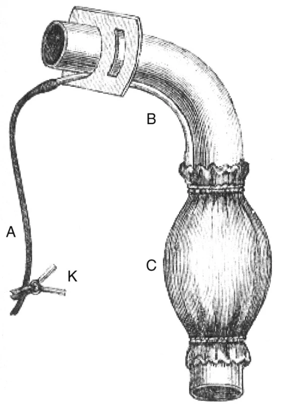 Trendelenburgova tamponovací kanyla (A. přívod k balonku, B. hadička na kanyle, C. tamponovací balonek