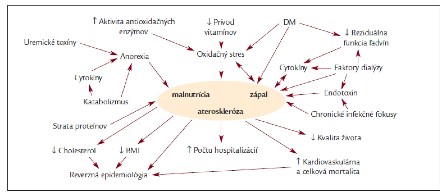 Schéma etiopatogenézie a dôsledkov syndrómu MIA (DM: diabetes mellitus, BMI: body mass index).
