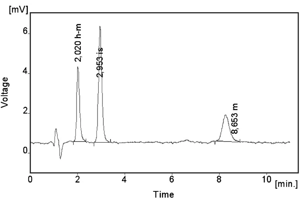 Chromatogram pacientského vzorku – koncentrace metoprololu (m) 84,8 ng/ml a koncentrace α-hydroxymetoprololu (h-m) 162,7 ng/ml