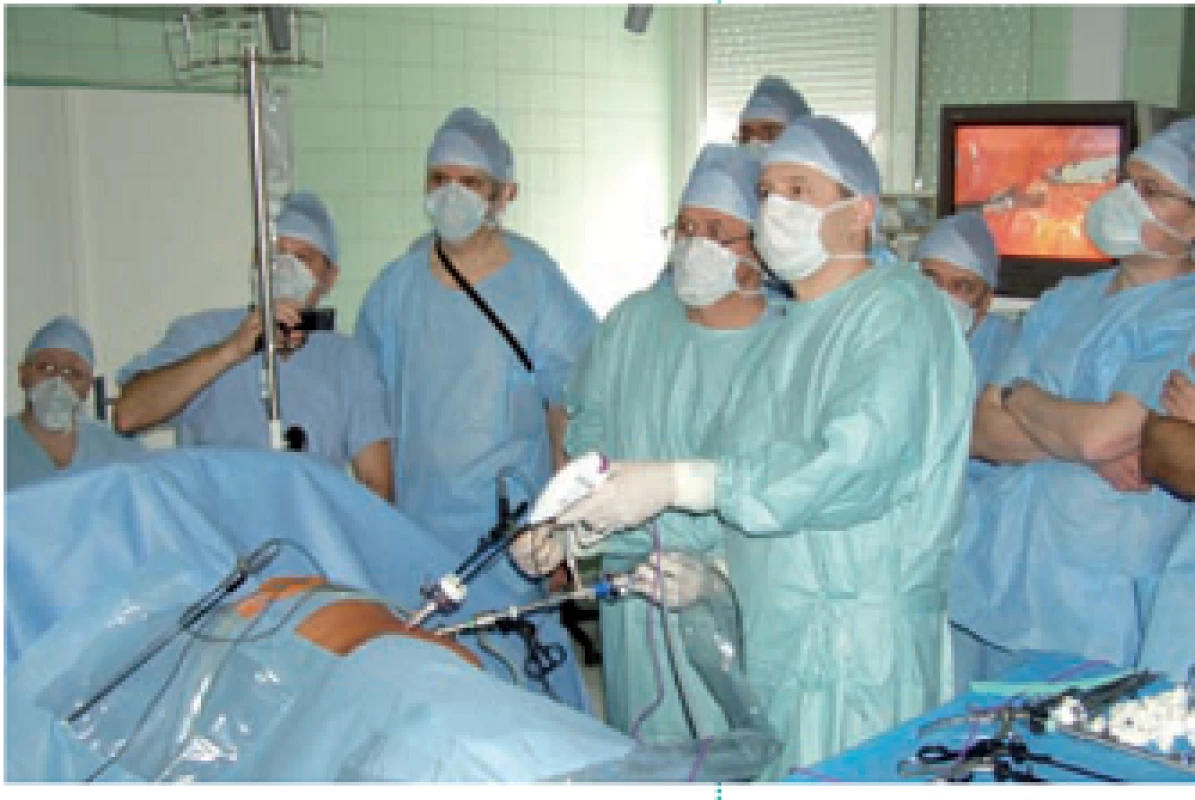 Doc. Milan Hora a doc. Ivan Minčík pri laparoskopickej resekcii nádoru dolného pólu pravej obličky