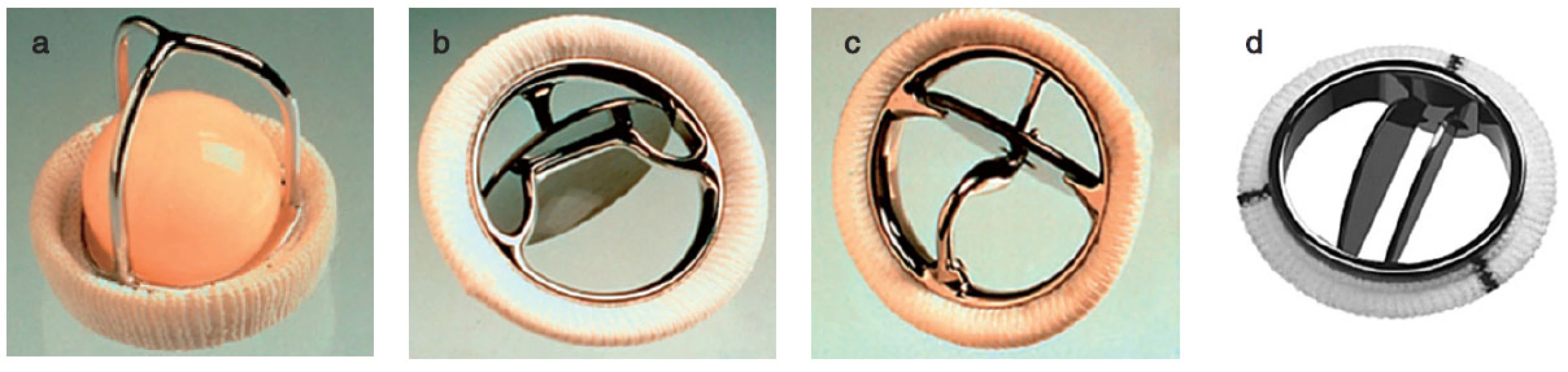 Příklady mechanických protéz
a – Starr-Edwards caged-ball, b – Bjork-Shiley tilting disc, c – Medtronic Hall tilting disc, d – Medtronic Hall tilting disc