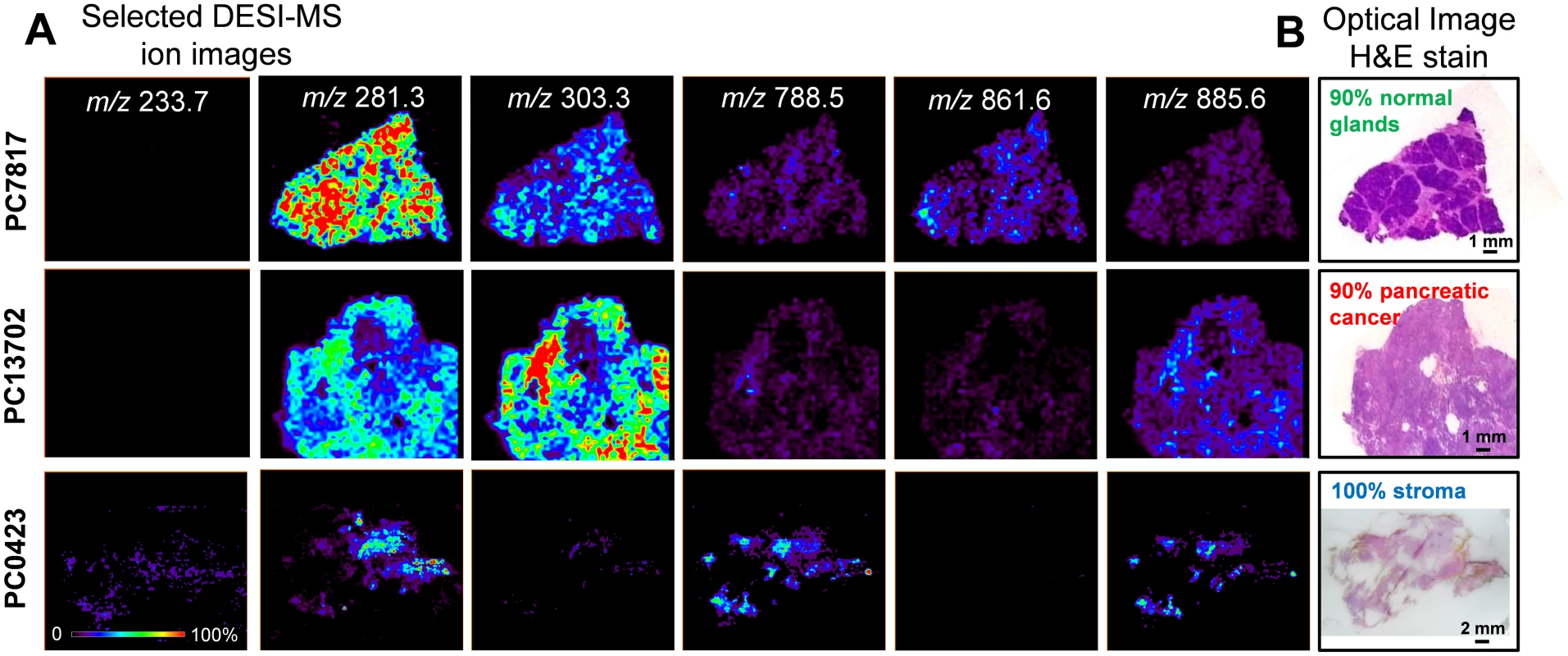 Selected 2-D negative ion mode DESI-MSI ion images obtained from pancreatic tissue samples.