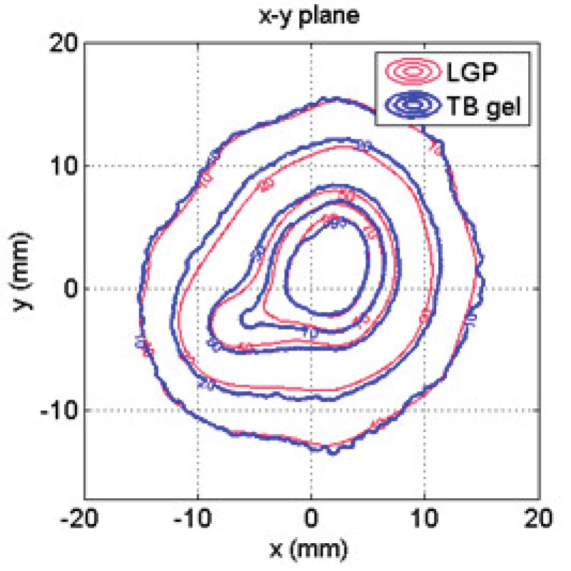 Porovnání dávkových distribucí naměřené pomocí gelového dozimetru a exportované z plánovacího systému LGP ve formě izodóz (10, 20, 50, 70 a 90 %) v centrálním řezu objemu.