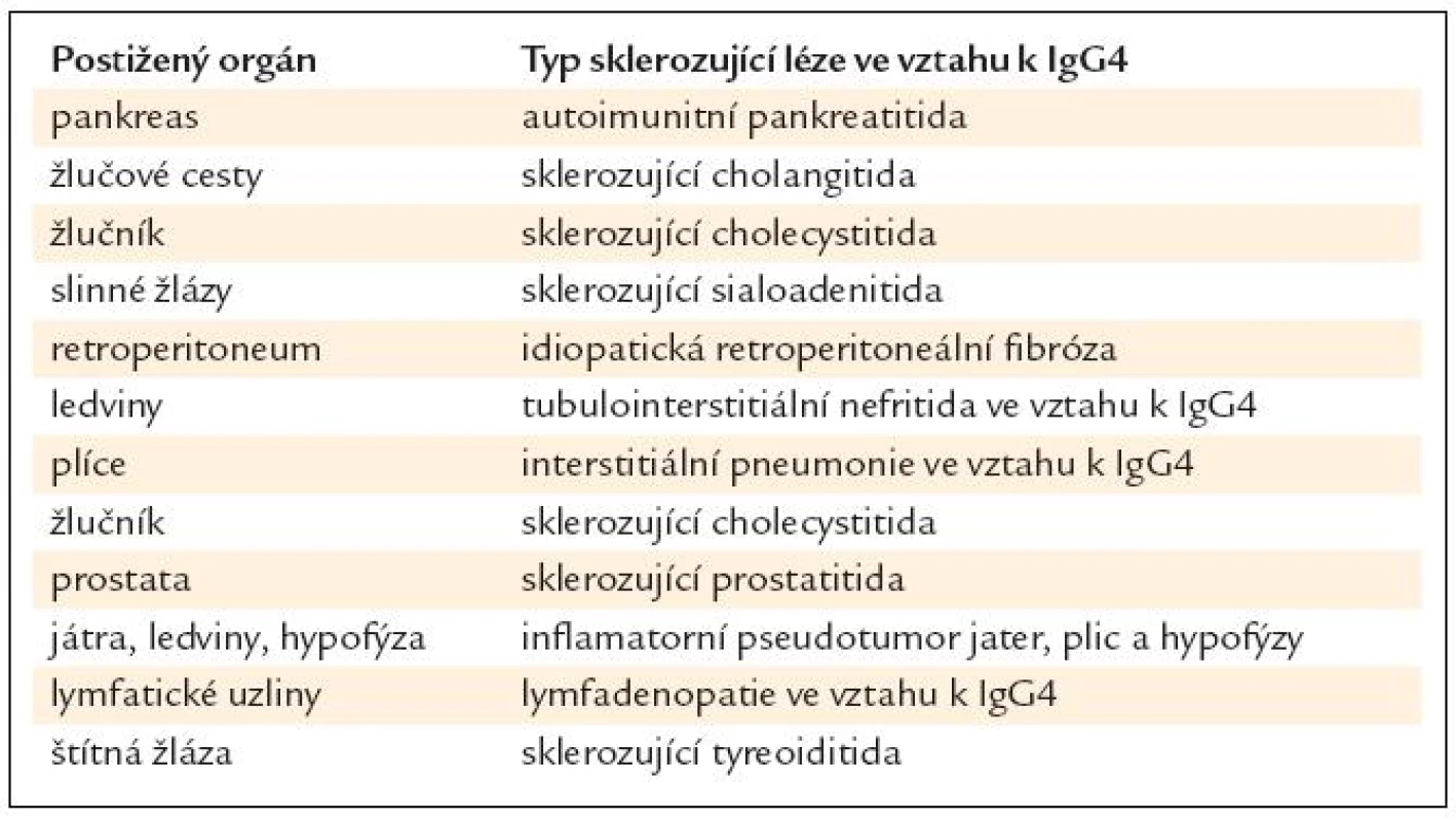 Sklerozující léze ve vztahu k IgG4 jsou často asociovány s autoimunitní pankreatitidou, četné jsou však i případy sklerozující léze ve vztahu k IgG4 bez asociace s tímto typem pankreatitidy.