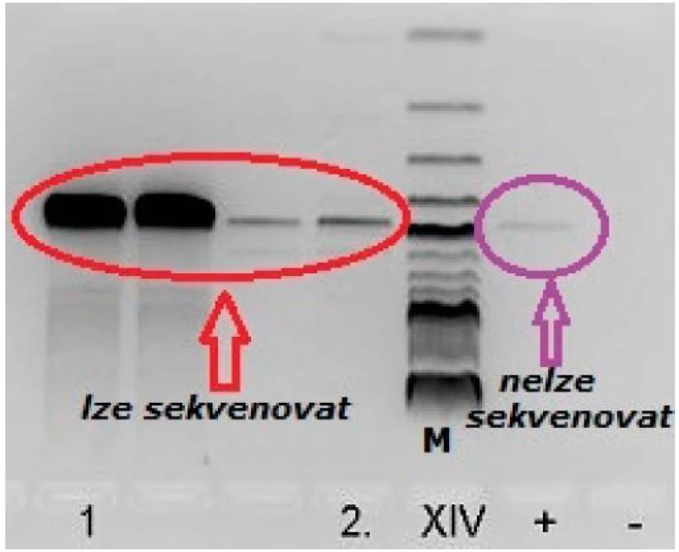 Průkaz bakteriální DNA (monitor před sekvenační reakcí); M – marker