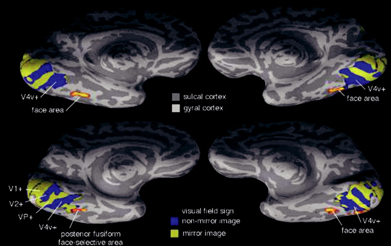 Laterální a ventrální pohled na pravou a levou hemisféru
Sulcal cortex kůra rýh mezi závity
Gyral cortex kůra závitů
Face area tvářová oblast
Posterior fusiform … oblast zadní části g. fusiformis aktivovaná při prohlížení tváří