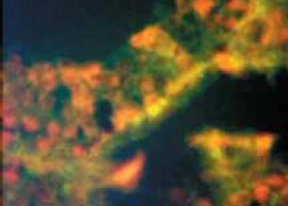 Imunofluorescenční průkaz chlamydií v řezech varlat infikovaných králíků.