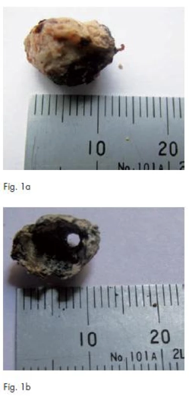 Eye macropreparations after fixation in formalin (Fig. 1A). Biomineral component after heat treatment of the material (Fig. 1B).