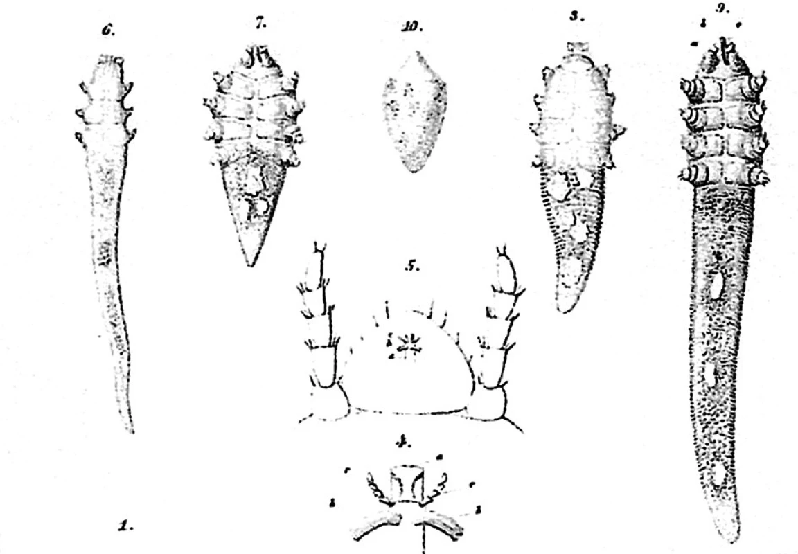 Demodex-Milben. Aus der Publikation von Simon (1848)