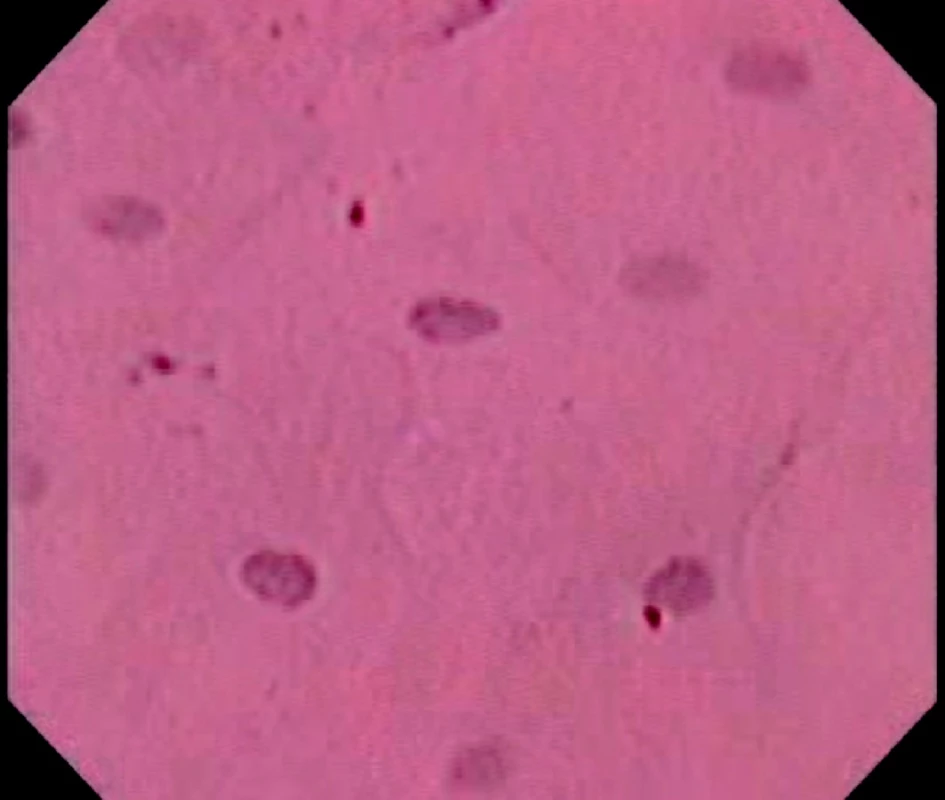 Endocytoskopický obraz normálního epitelu jícnu