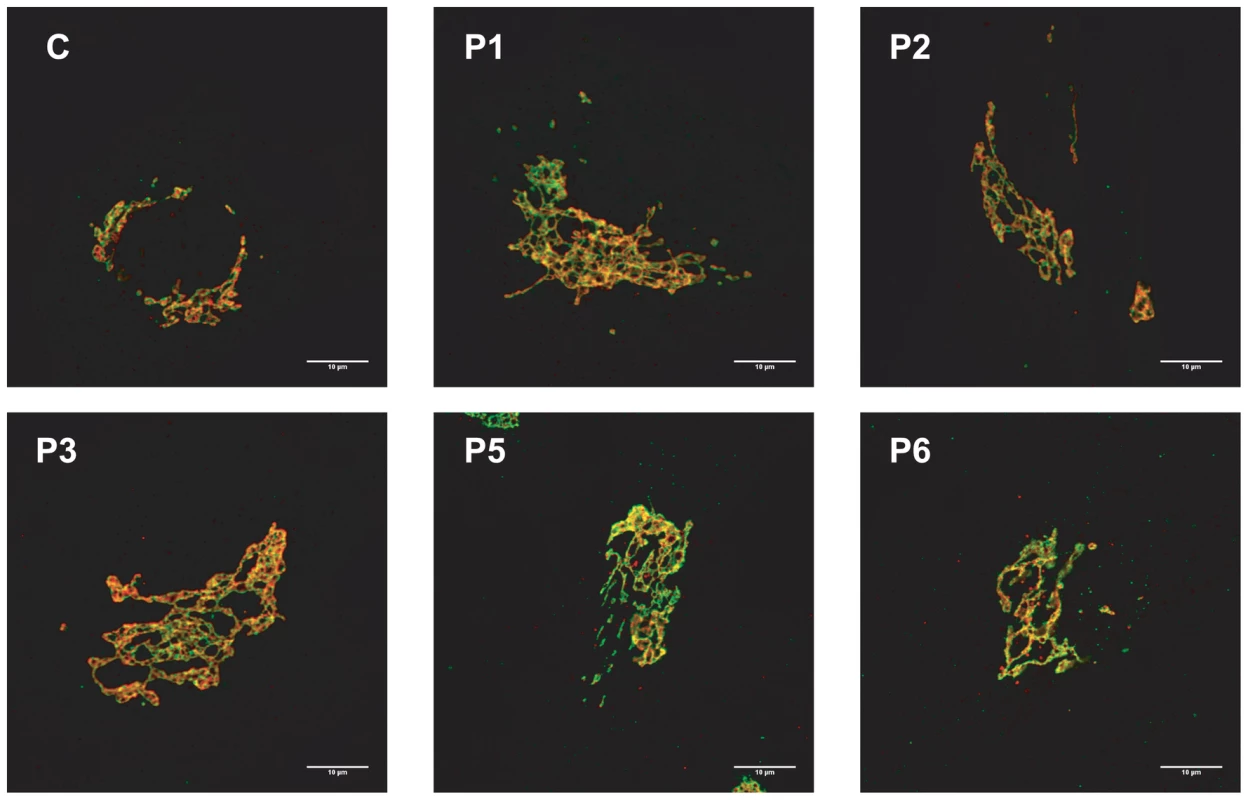 MAN1B1-deficient fibroblasts present alterations in Golgi structure.