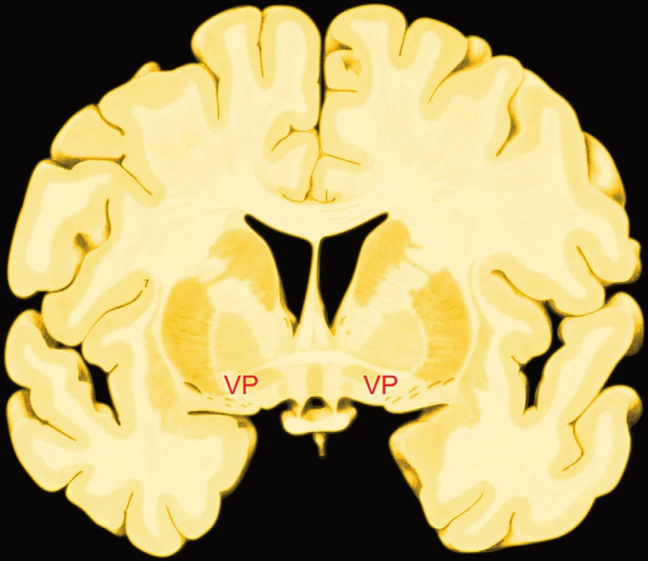 Poloha ventrálního palida, čelní řez na úrovni chiasma opticum