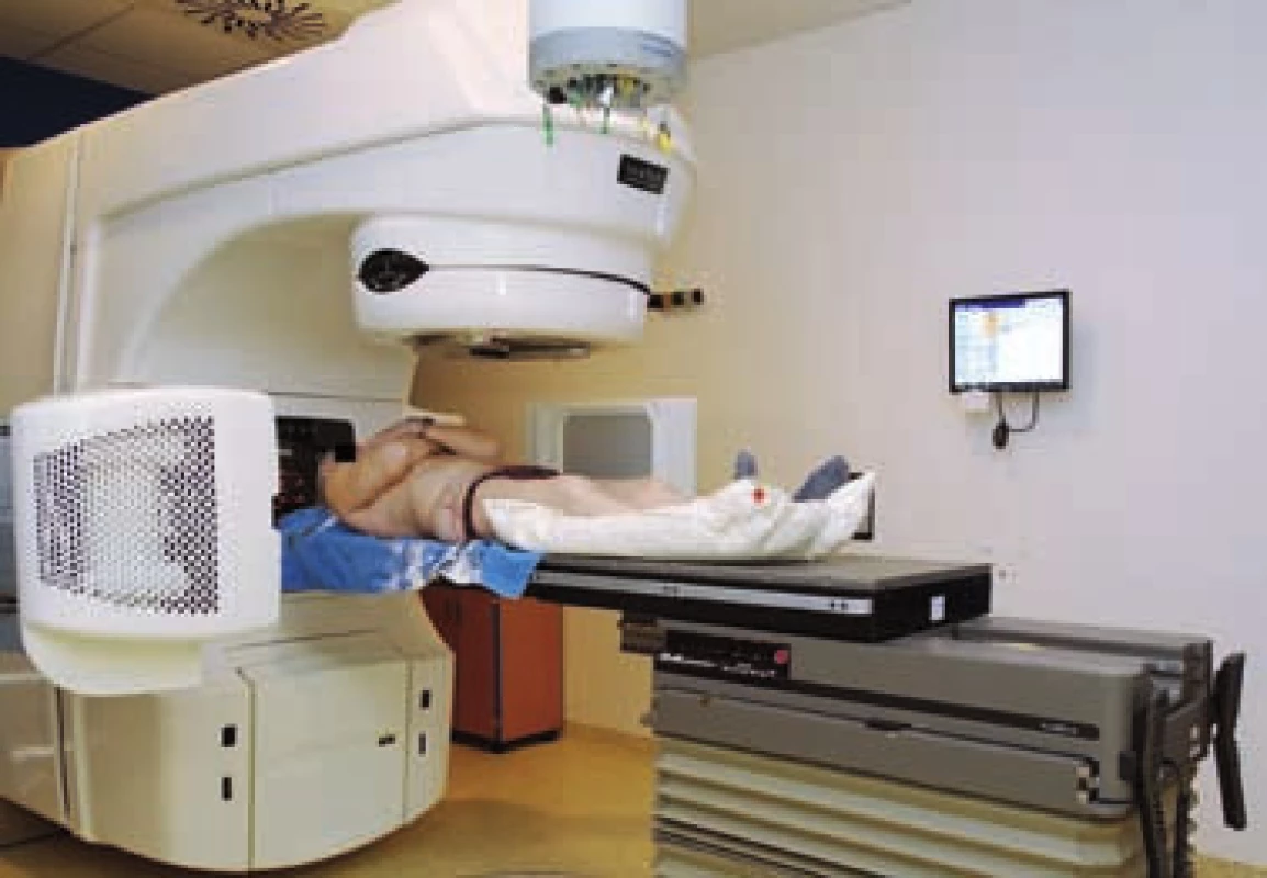 Lineární urychlovač se zobrazovacím systémem – radioterapie řízená obrazem (IGRT)
Fig. 8 Linear accelerator equipped with imaging device – image-guided radiation therapy (IGRT)