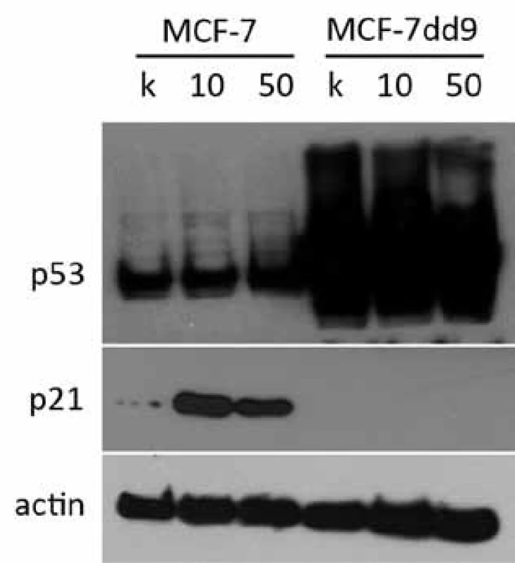 Indukcia p21 po ovplyvnení 10 a 50 nM NVP-AUY922 po dobu 24 hod. U parentálnej línie MCF-7 bol po ovplyvnení NVP-AUY922 pozorovaný výrazný nárast hladiny p21 oproti kontrole, čo vysvetľuje indukciu G1 bloku po inhibícii HSP90. U línie MCF-7dd9 s mutovanou p53 nebol pozorovaný nárast expresie p21, čo naznačuje, že zmena jeho hladiny po inhibícii HSP90 je p53 závislá.
