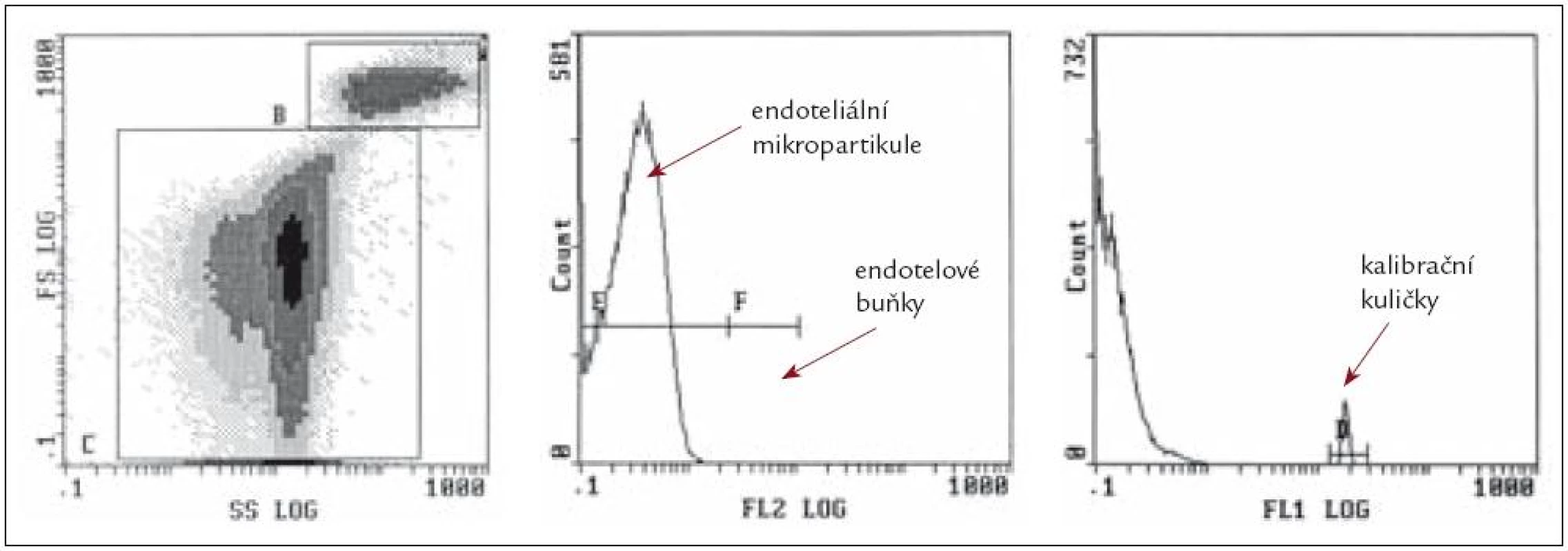 Příklad flowcytometrického stanovení endoteliálních mikropartikulí.