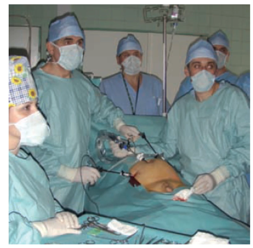 Doc. Radim Kočvara počas laparoskopickej operácie abdominálnej retencie semenníka