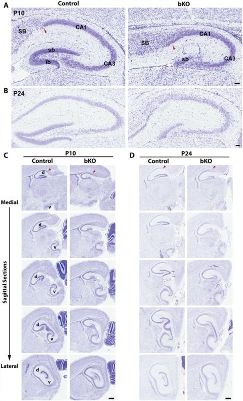 Forebrain-specific Brpf1 loss causes hypoplasia of the dentate gyrus.