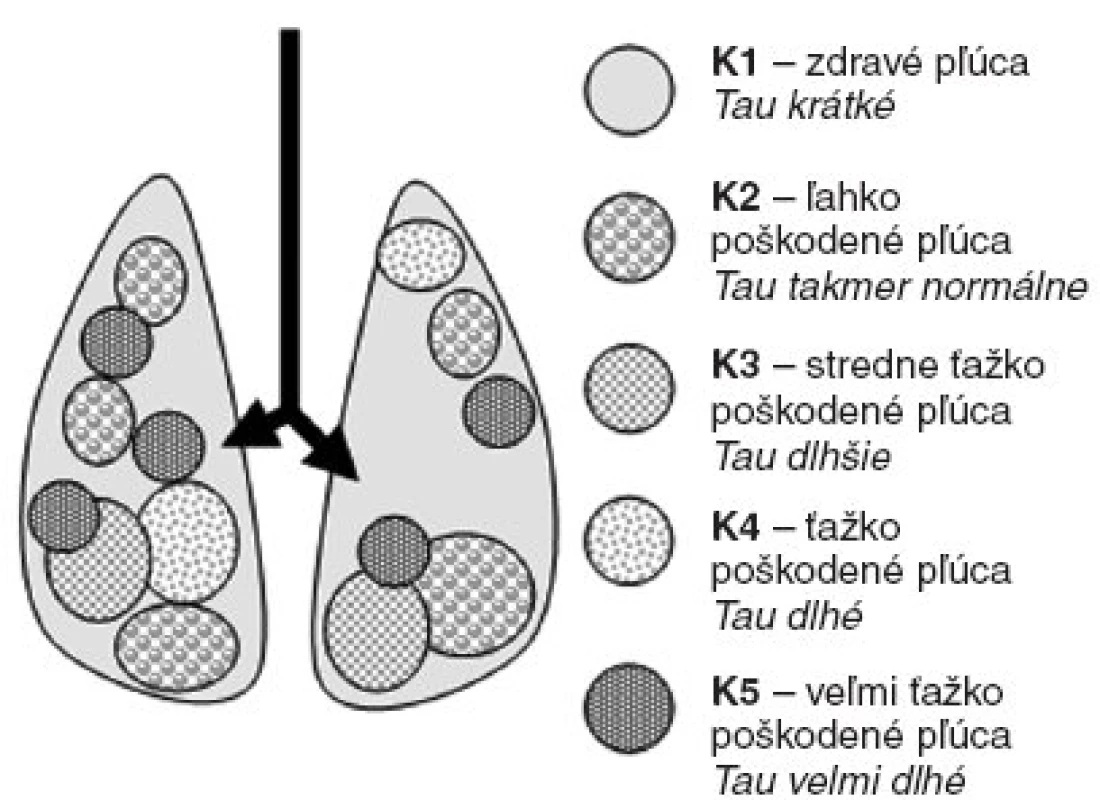 Schematické znázornenie difúzne nehomogénne poškodených pľúc