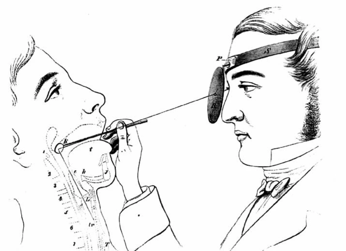 Kresba vysvětlující laryngoskopické vyšetřování