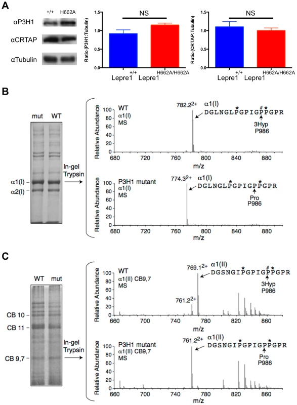 Loss of Prolyl 3-hydroxylation at Pro986 in type I collagen in bone and type II collagen in cartilage.