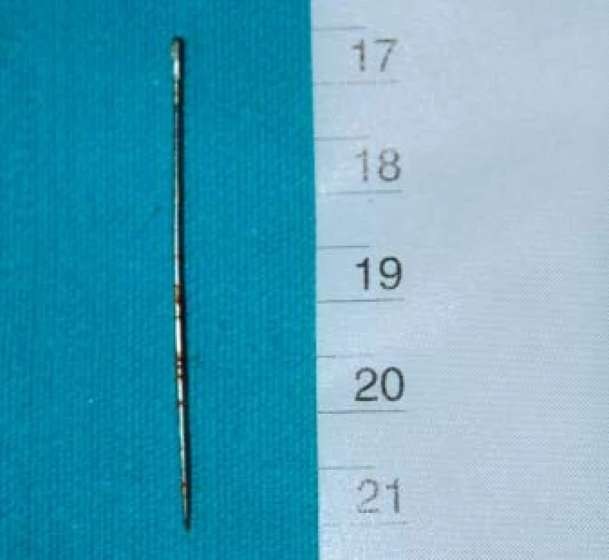 Kovová jehla (užita 11letým chlapcem s dosud malým penisem), 45 mm dlouhá jehla poranila zadní uretru.