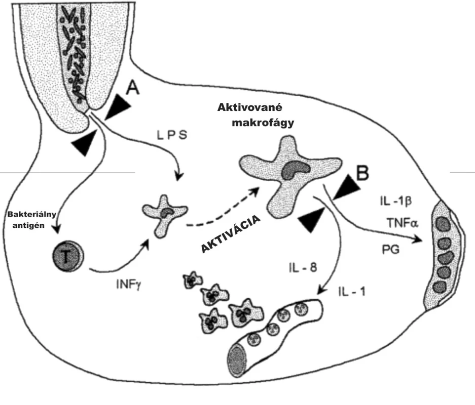 Eliminácia deštruktívnych mediátorov makrofágov (A) Tradičný spôsob: ošetrením koreňového kanálika, elimináciou stimulujúcich podnetov aktivácie, ako bakteriálnych antigénov a lipopolysacharidu – LPS. (B) Navrhovaná metóda: farmakologicky použitím steroidov, tetracyklínov, antagonistov receptorov alebo nesteroidných antiflogistík, ktoré interferujú s produkciou mediátorov alebo s ich pôsobením [9].
Fig. 11. Elimination of destructive macrophage mediators (A) Conventional method: root channel treatment and elimination of activation stimuli such as bacterial antigens and lipopolysaccharide – LPS. (B) Candidate method: Pharmacotherapy with steroids, tetracyclines, receptor antagonists or non-steroidal anti-inflammatory drugs interfering with mediator production or action [9].
