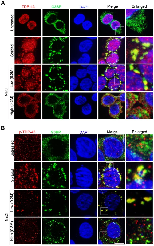 Hypertonic stress with NaCl induces different forms of cytoplasmic translocation and granule formation of TDP-43 in a concentration-dependent manner.