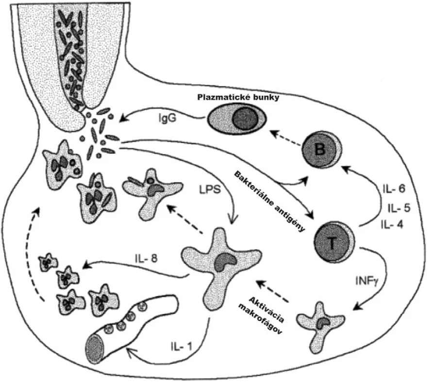 Ochranná úloha aktivovaných makrofágov a T lymfocytov v periapikálnych granulómoch Aktivácia T lymfocytov vedie k antigénšpecifickej aktivácii B lymfocytov a lokálnej produkcii špecifických protilátok. Tiež vedie k aktivácii makrofágov, čo má za následok zvýšenie fagocytózy týchto buniek, rovnako ako zvýšenie cytokínmi sprostredkovanej marginácie PMNL, chemotaxie a ich aktivácie. Aktivácia makrofágov sa môže dosiahnuť i nezávisle od T lymfocytov bakteriálnym endotoxínom (lipopolysacharidom – LPS) 9.
Fig. 10. The protective role of activated macrophages and T lymphocytes in periapical granuloma T lymphocyte activation induces an antigen-specific B lymphocyte response and local production of specific antibodies. It also activates macrophages which results in increased phagocytic activity of these cells as well as in increase in cytokine mediated PMNL marginalization, chemotaxis and their activation. Macrophage activation can also be induced independently of T lymphocytes by a bacterial endotoxin (lipopolysaccharide – LPS) 9.