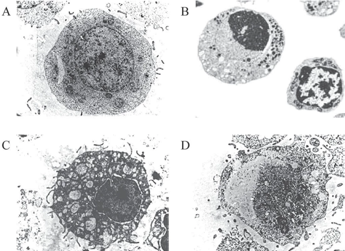Buňka s normální, apoptotickou, autofagickou a nekrotickou morfologií.
Nasnímáno elektronovým mikroskopem, zvětšení 4 400×, upraveno dle [91]. U zdravé buňky pozorujeme obvyklý tvar jádra i celé buňky (A), u apoptotické chromatin kondenzovaný v jádře a zmenšení objemu buňky (B), u autofagické výrazně vakuolizovanou cytoplazmu a jádro bez kondenzovaného chromatinu (C) a u nekrotické ztrátu integrity membrány a buněčného obsahu (D).