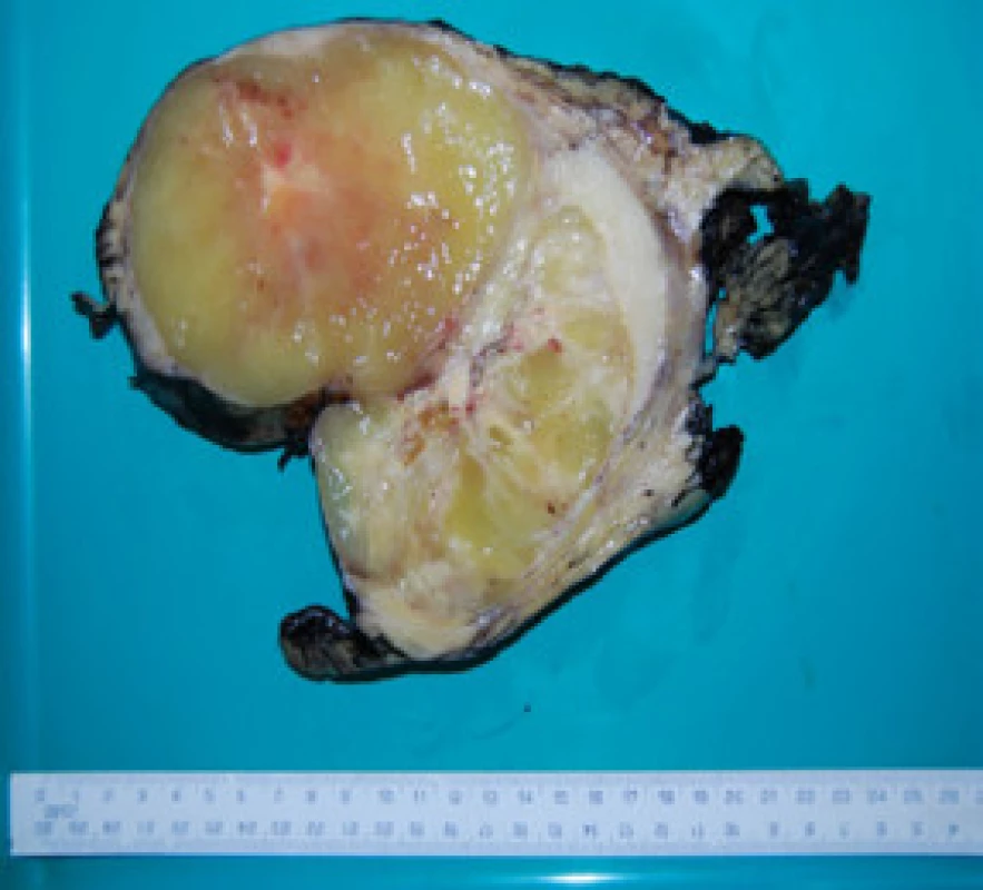 Řez tumorem
Fig. 3. Cross section of the tumor