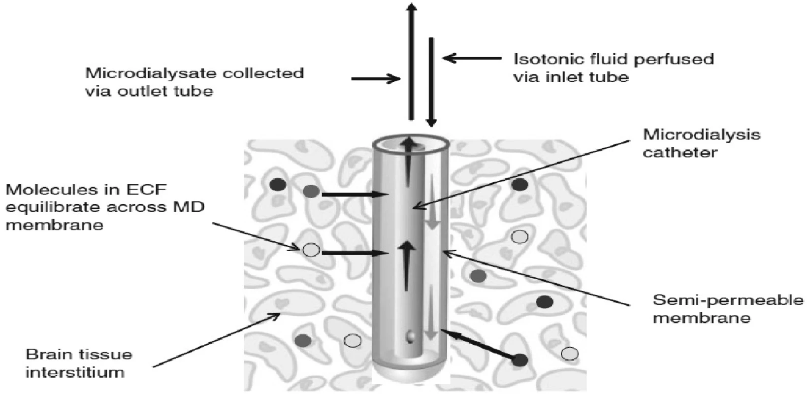 Princip mikrodialýzy a zapojení mikrodialyzačního katétru – schéma (firemní dokumentace)