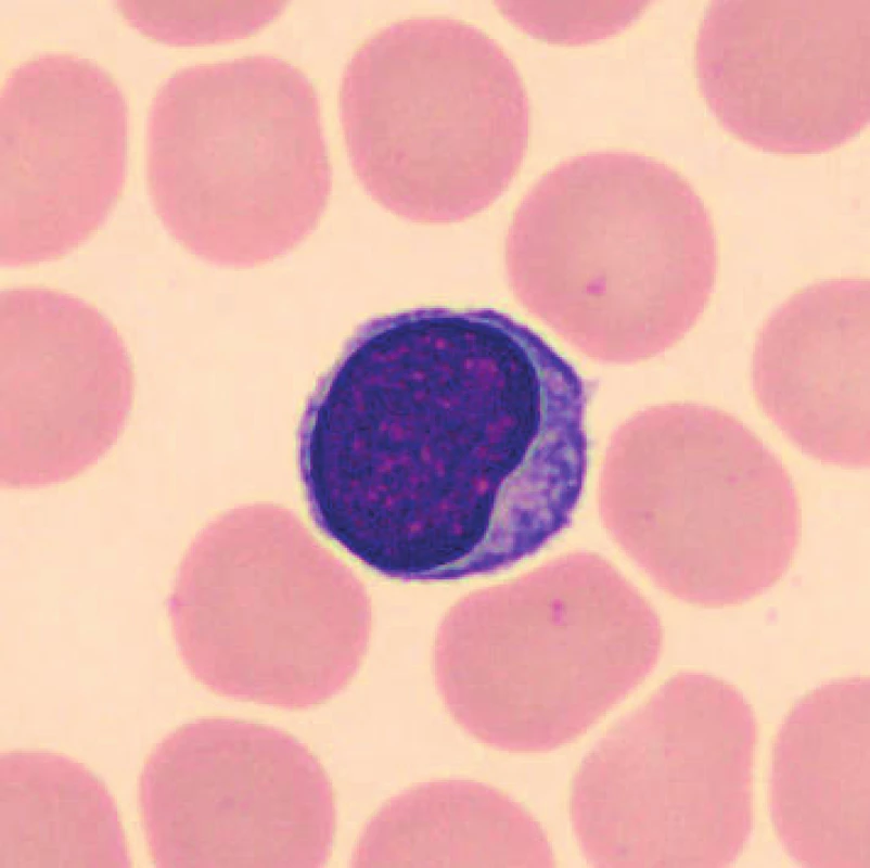 Lymfocyt (20 minut po odběru, laboratorní teplota)