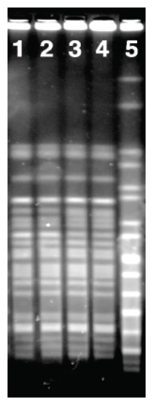 PFGE kmenů NSF EHEC O157 izolovaných ze stolice dítěte s krvavým průjmem a trusu ovce z rodinné farmy. V dráhách 1-4 jsou PFGE profily těchto kmenů:
1-2, kmen od pacienta;
3-4, kmen od ovce. Dráha
5 obsahuje referenční kmen
Salmonella Braenderup H9812.
Fig. 5. PFGE patterns of NSF EHEC O157 isolates from the stool of a child with bloody diarrhea and from the feces of a family farm sheep Lanes 1–4: PFGE profiles of the following strains:  1–2, strain from the patient, 3–4 L 0 strain from the sheep. Lane 5: reference strain Salmonella Braenderup H9812.