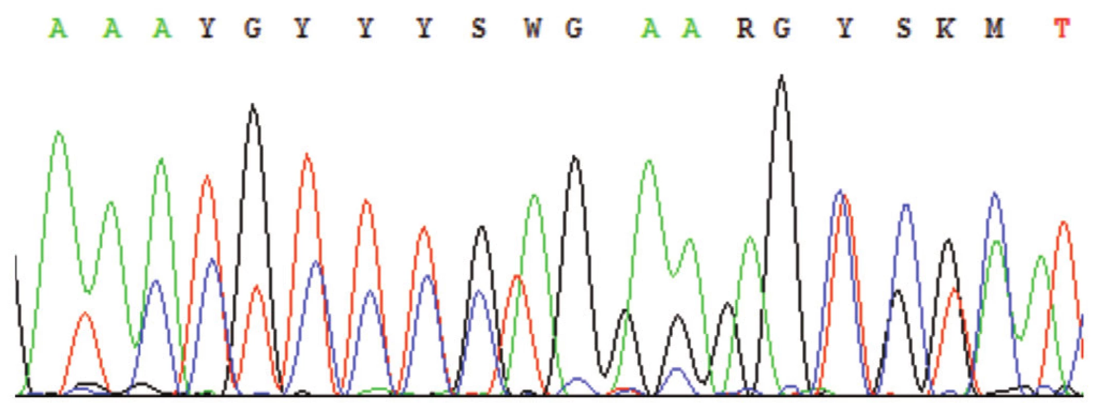 Sekvenogram – příklad výskytu nespecifických píků; nejčastěji z důvodu nedostatečného přečištění PCR od primerů, přítomnosti více produktů v sekvenační reakci, nízké specifičnosti primerů aj. (Označení píků K, M, R, S, W, Y – nomenklatura dle IUPAC-IUB, např. http://www.ncbi.nlm.nih.gov/staff/tao/tools/tool_lettercode.html.)