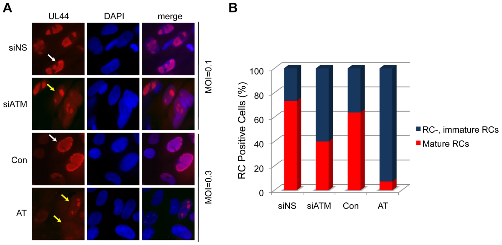 Reduced formation of “mature” viral replication compartments (RCs) in AT fibroblasts and siATM-transfected HEL fibroblasts.