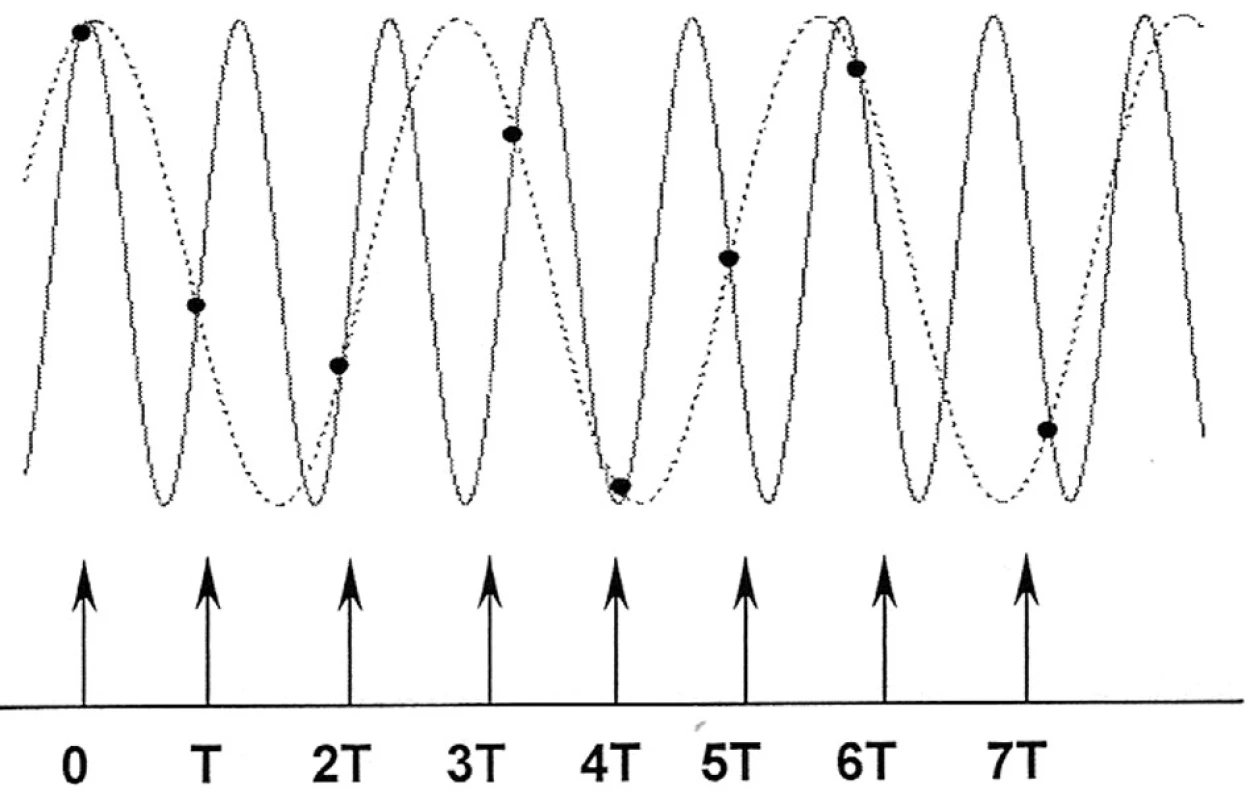 Aliasing – chybná interpretace vyšších kmitočtů vlivem nízké vzorkovací frekvence (šipky). Původní signál je označen plnou čárou, výsledný signál je označen tečkovanou čárou (Mohylová, Krajča, 2004).