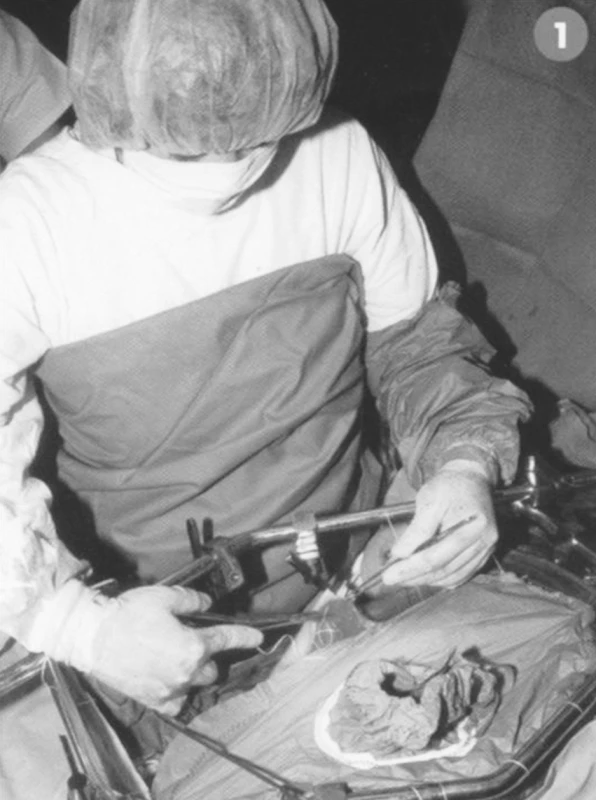 Retraktor a fólie uzavírající operační ránu před laváží