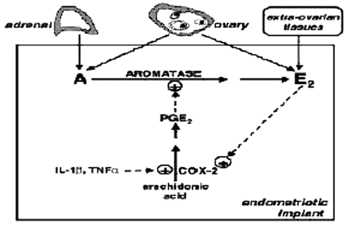 Schematické znázornenie aromatázovej aktivity v endometrióznom ložisku [3]. A- androgény, E2- estradiol