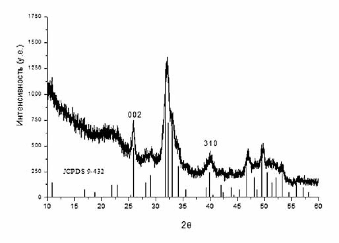 Original diffraction of mineral material of pathological eye formation, vertical lines indicate the position and intensity of the peaks of hydroxyapatite Ca&lt;sub&gt;10&lt;/sub&gt;(PO&lt;sub&gt;4&lt;/sub&gt;)&lt;sub&gt;6&lt;/sub&gt;(OH)&lt;sub&gt;2&lt;/sub&gt; according to the reference data JCPDS 9-0432.