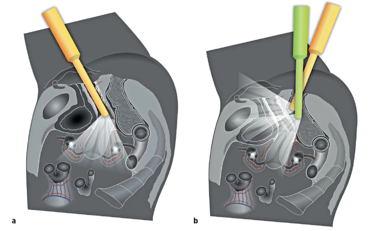 Ultrazvukové vyšetření pánevní anatomie