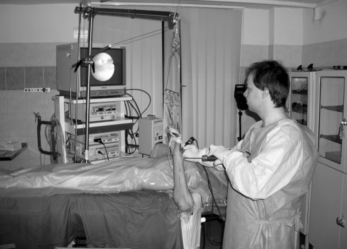 Praktická výuka artroskopie zápěstí na fixovaném kadaveru