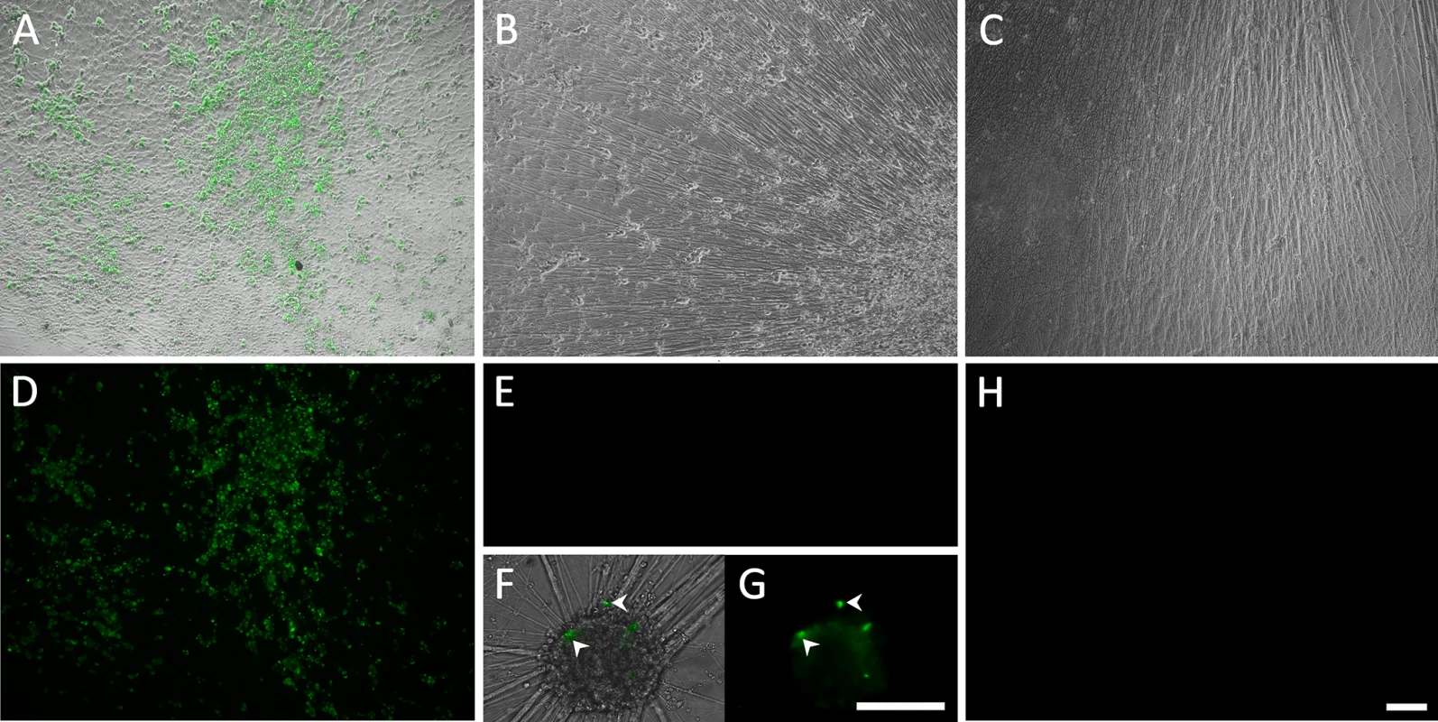 Living cultures of hESC-derived neurons infected with VZV-GFP66.