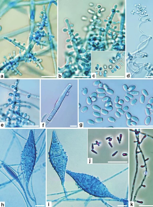 Mikromorfologie <i>A. benhamiae</i> (a–g) a <i>M. canis</i> (h–k)