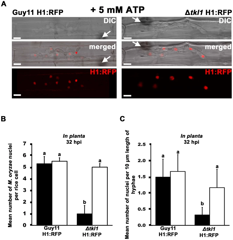 Mitotic delay is remediated <i>in planta</i> by treating Δ<i>tkl1</i> H1:RFP mutant strains with exogenous ATP.