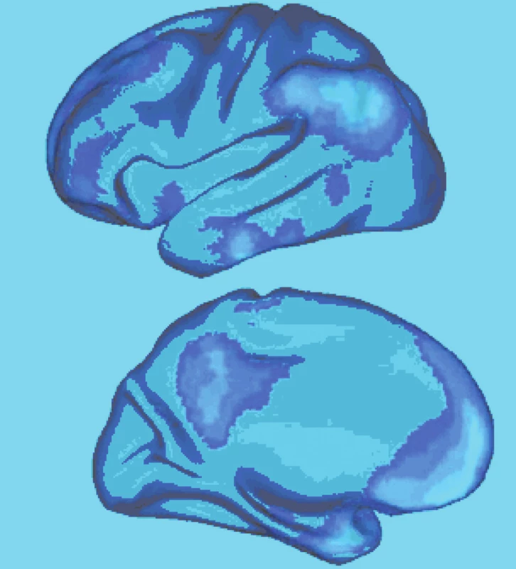 Implicitní (default) síť lidského mozku. Zevní a vnitřní plocha levé hemisféry. Dle Buckner et al. 2008 (2).